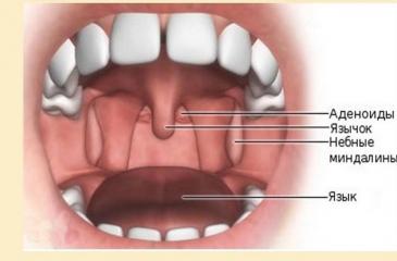 Tonsils and tonsils - what's the difference?