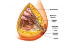 Perché si sviluppa l'adenosi della ghiandola mammaria e come trattare questa condizione Adenosi della ghiandola mammaria semplice